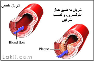 الجيريا