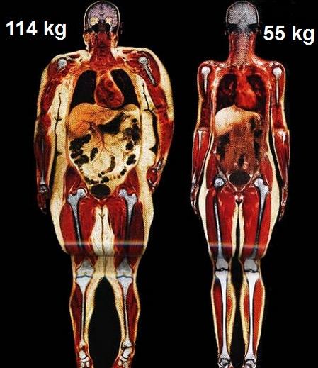 :  body-scans.jpg
: 11739
:  43.9 